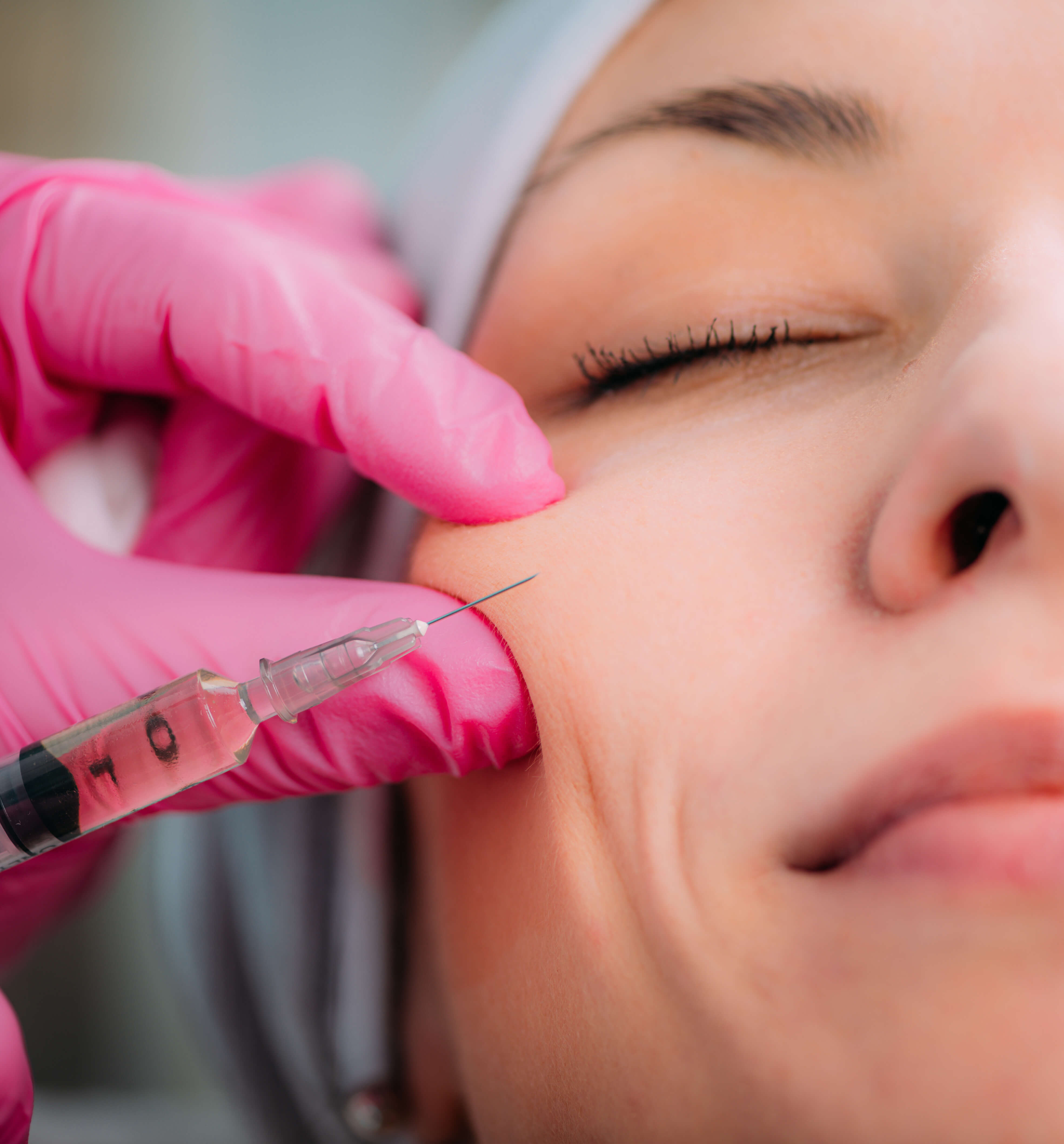 Dermal Fillers